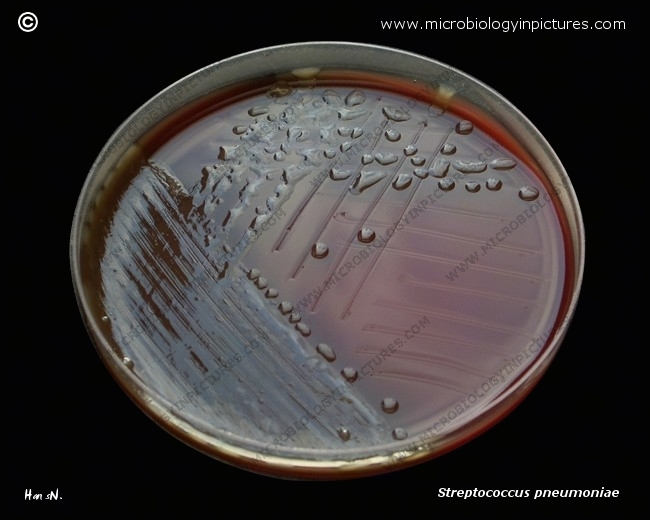 pneumococcus